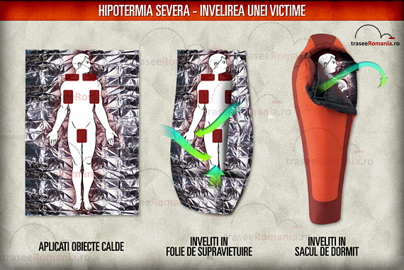 Hipotermia - selectieoferte.ro